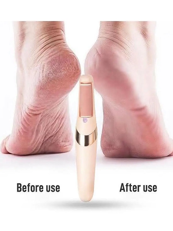 WEIMEI Rechargeable Electric Foot File Callus Remover | Professional Pedicure Tool